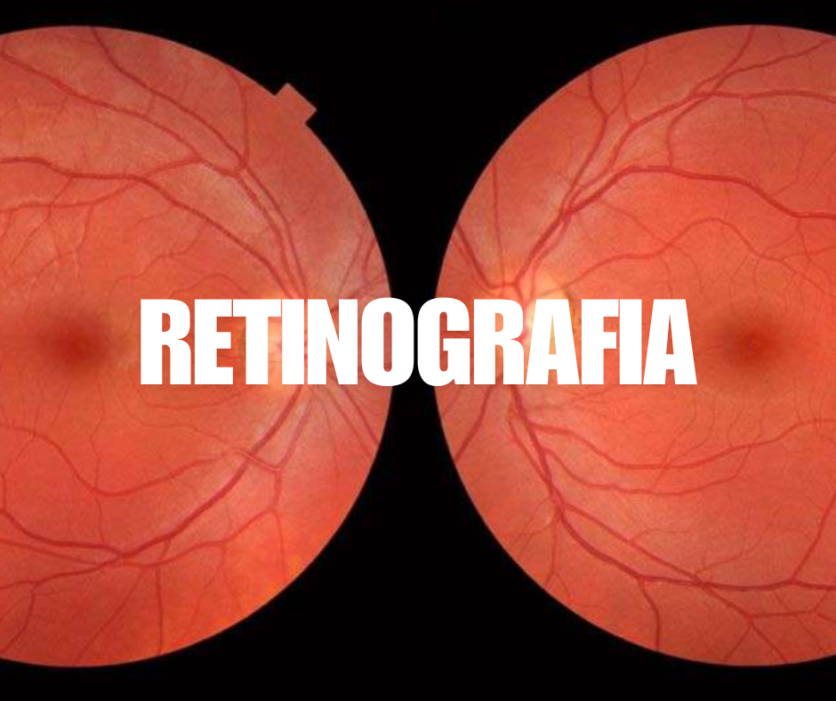 Retinografia